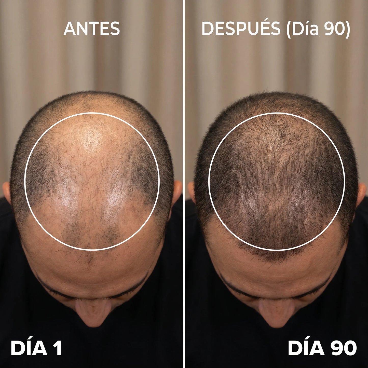 NUVIA LED PRO |  recuperación capilar terapia luz roja