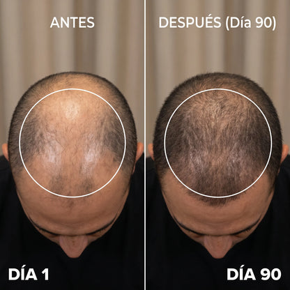 NUVIA LED PRO |  recuperación capilar terapia luz roja