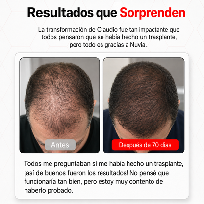NUVIA LED PRO |  recuperación capilar terapia luz roja